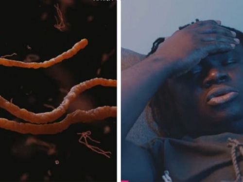 馬爾堡病毒蔓延？9人確診20疑似個案死亡　CDC急派員赴非協助抗疫