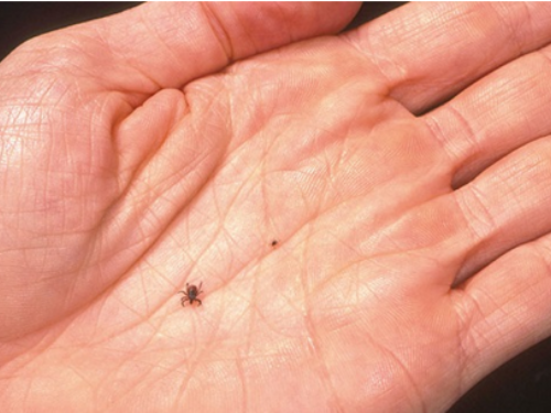 清明掃墓踏青請做好自我防護 遠離恙蟲病威脅