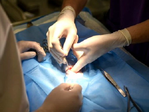 為什麼手術前需要禁食？連吃藥也不行嗎？